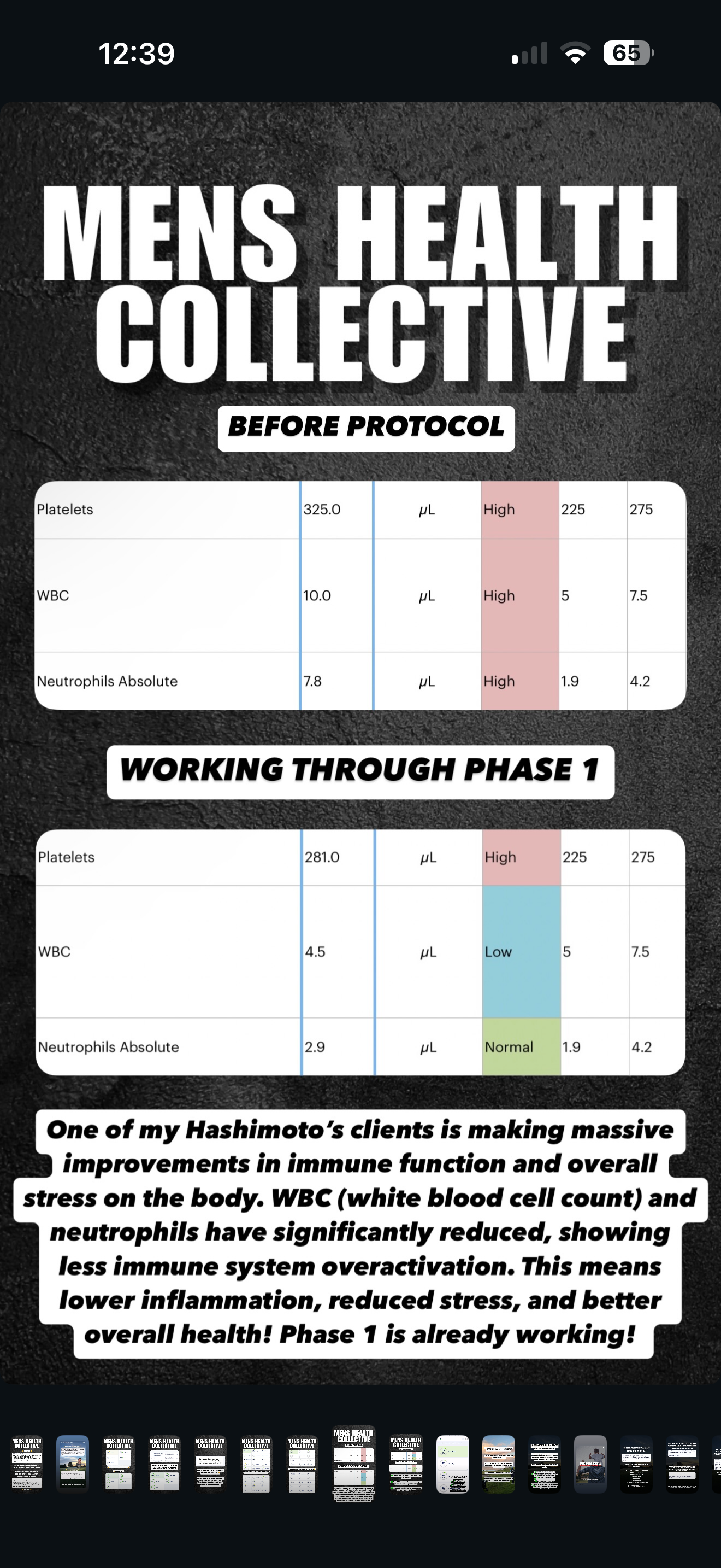Hashimoto's immune function bloodwork before and after comparison