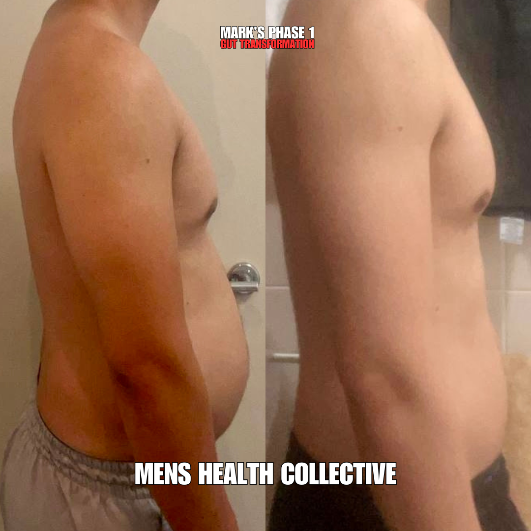 MHC client Phase 1 transformation, side view